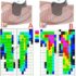 Can Hoof Shape Influence Saddle Slip?