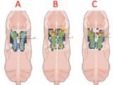 Saddle Fitting – A Complex Process!
